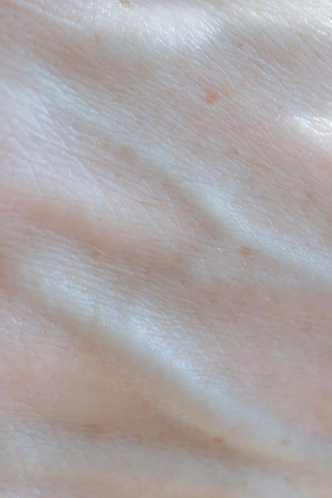 A close up image of skin texture