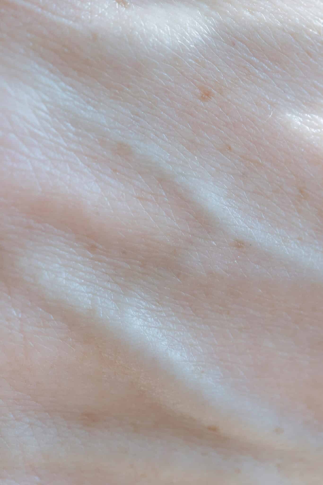 A close up image of skin texture